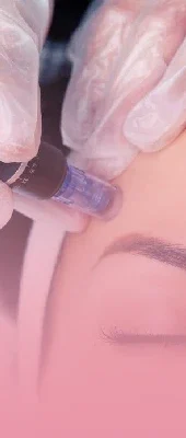 Microneedling (2)